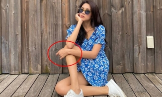 Hà Tăng gầy gò đáng báo động với đôi tay và chân nổi gân chằng chịt