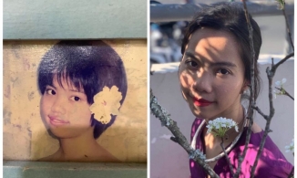 Trải nghiệm chỉnh nha, sửa răng của cô gái từng bị bạn bè gọi là 'vịt Donald' vì sở hữu hàm răng hô