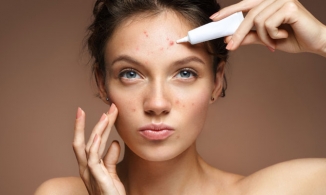 [Kinh nghiệm] Các bước chăm sóc da mụn tại nhà