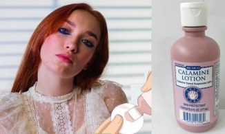 Mối nguy hại khủng khiếp từ kem dưỡng da chứa calamine 