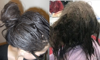 Sợ hói đầu, 1 cô gái nhịn gội trong 3 tháng, kết quả mất 11 triệu để gỡ rối