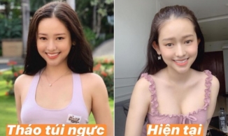 Thúy Vi xuất hiện với vòng 1 căng đầy vướng nghi vấn đặt lại túi ngực