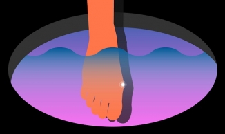 7 cách loại bỏ vết chai trên chân tốt nhất, hiệu quả nhất