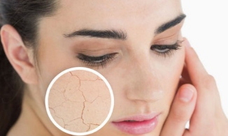 Đây là cách khắc phục da khô sần, thiếu nước trong những ngày đông