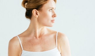 Bật mí cách thoát khỏi tình trạng tăng sắc tố trên da