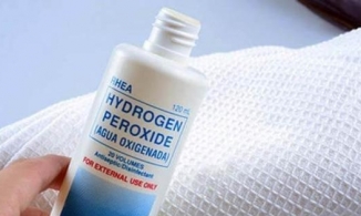 7 cách sử dụng nước oxy già (Hydrogen peroxide) để điều trị mụn hiệu quả