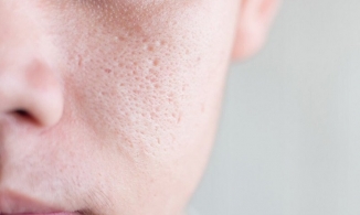 Mẹo trang điểm giúp lỗ chân lông trở nên tàng hình