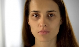 Nguyên nhân khiến mắt trũng sâu, mệt mỏi, thiếu sức sống