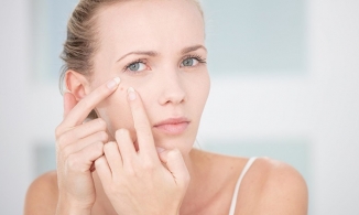 Những cách trị mụn đầu trắng trên mặt và mũi hiệu quả tại nhà