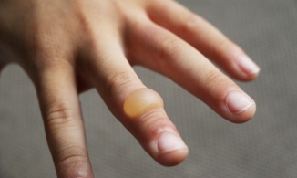 Hướng dẫn cách trị mụn nước hiệu quả