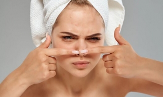 Mụn mũi thật khó chịu và đây là cách trị mụn trên mũi