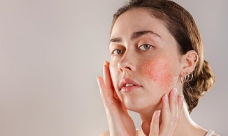 [Review]Top 20 Kem dưỡng ẩm cho da nhạy cảm tốt nhất hiện nay