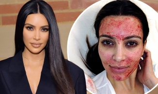 Kim Kardashian ước mình chưa bao giờ làm đẹp bằng máu 
