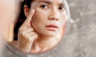 Đừng để tuổi 30 hối hận vì không chống lão hóa sớm 