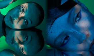 Người mẫu có gương mặt đầy tan nhang nhưng vẫn nổi danh thế giới