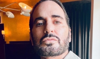 NTK Marc Jacob chi nhiều tiền để phẫu thuật nâng cơ mặt phẳng sâu