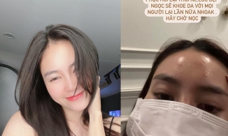 Ninh Dương Lan Ngọc thức khuya và cái 'kết đắng' dành cho làn da