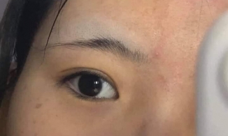 Những phương pháp làm đẹp chị em không nên thử tại nhà nếu không muốn mất Tết