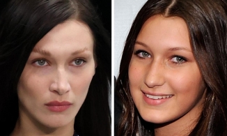 Bella Hadid thú nhận rất hối hận vì đã can thiệp dao kéo một bộ phận trên gương mặt
