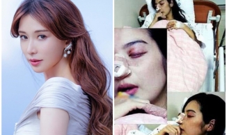 'Nữ hoàng nội y Đài Loan' Lâm Chí Linh bị ông xã kém tuổi bạo hành tới mức nhập viện