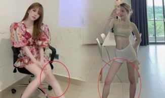 Thiều Bảo Trâm lên tiếng về đôi chân tong teo như sắp gãy