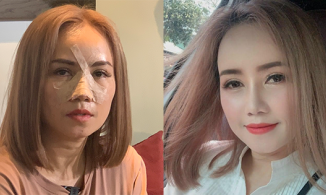 'Cô Xuyến' Hoàng Yến khoe diện mạo mới sau 2 tuần bị chồng cũ 'đấm vỡ mũi'