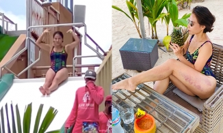 Thu Minh diện áo tắm, vô tình để lộ vết bầm bất thường dọc đùi