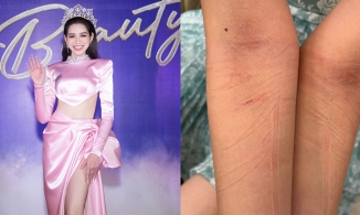 1 giờ đi sự kiện của Đỗ Thị Hà: Đằng sau hình ảnh hoàn hảo, nụ cười rạng rỡ là hai cánh tay rướm máu