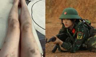 Cận cảnh đôi chân biến dạng của Hòa Minzy sau khi vô địch Sao nhập ngũ