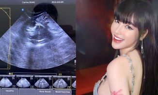 Elly Trần phủ nhận mang bầu lần 3, ảnh siêu âm thai là của mèo cưng