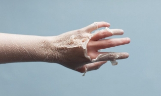 Suy nghĩ mùa đông không cần kem chống nắng là một sai lầm