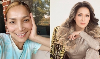 Nhan sắc ca sĩ Hồng Ngọc sau 1 năm bị tai nạn bỏng mặt