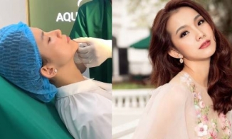 Thùy Lâm công khai đi tiêm cằm sau 13 năm đăng quang Hoa hậu Hoàn vũ Việt Nam 