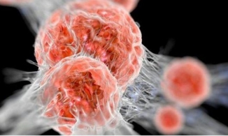 Các nhà khoa học đã tìm ra phương pháp mới giúp thu nhỏ khối u ác tính 