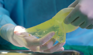 Nâng ngực giá 58 triệu đồng, bệnh nhân bị vỡ túi silicon