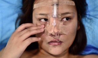 Nhiều người trẻ Trung Quốc vay nợ tân trang nhan sắc cho giống trên mạng