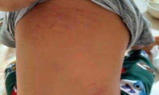 Ninh Bình: Trẻ 15 tháng bị cô giáo đánh trong nhà vệ sinh, 1 cô đứng nhìn