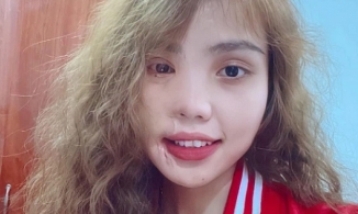 Cô gái bị tình cũ tạt axit nửa gương mặt cuốn hút trong bộ ảnh nghệ thuật