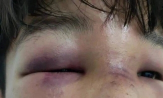 Phụ huynh hành hung bạn của con chỉ vì mâu thuẫn giữa con với bạn cùng lớp