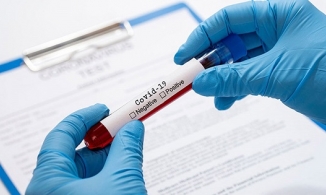 Test nhanh giúp phát hiện Covid-19 có giá bao nhiêu? 