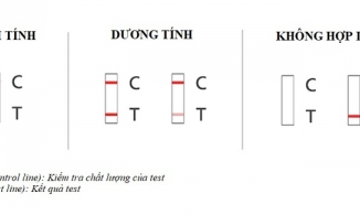 Cách tự test nhanh Covid tại nhà: 7 bước cơ bản dễ dàng, chính xác, không đau