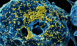 SARS-CoV-2 có thể tồn tại trong não bộ suốt nhiều tháng