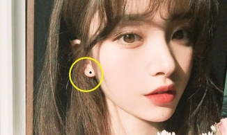 Có nốt ruồi ở  vị trí này là người giàu sang, trung vận cực vượng đừng dại tẩy đi