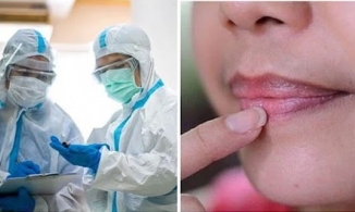Dấu hiệu nhiễm Omicron đặc trưng trên da, môi và móng tay, nhận biết sớm sẽ tự cứu mình