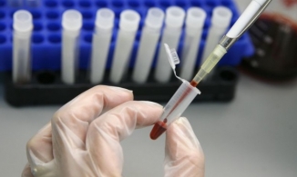 Lần đầu tiên trên thế giới có người khỏi HIV nhờ liệu pháp cấy tế bào gốc