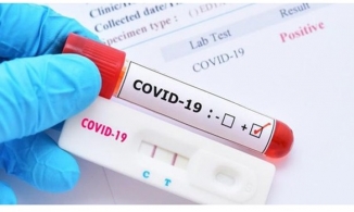 Bộ Y tế chấp nhận kết quả xét nghiệm nhanh thay cho kết quả xét nghiệm PCR