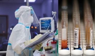 Giáo sư ĐH King's College London: Nhóm máu liên quan tới nguy cơ mắc COVID nặng, nhóm máu A số 1