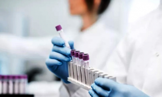 Giáo sư Đại học Mỹ cho biết xét nghiệm nước bọt có khả năng phát hiện Omicron hiệu quả hơn chọc mũi