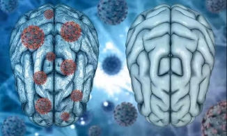 Nguyên GĐ BV Nhiệt đới TW: Covid-19 để lại 203 di chứng, 52% người gặp vấn đề về trí nhớ 