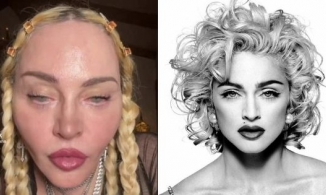 Huyền thoại Madonna khiến netizen choáng với gương mặt biến dạng ở tuổi 63